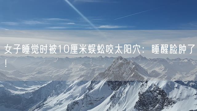 女子睡觉时被10厘米蜈蚣咬太阳穴：睡醒脸肿了！